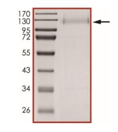 The purity of nCoV-S1 (∆Y145, ∆H146, E484K, D614G) was determined to be >90% by densitometry.